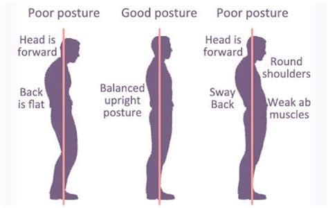 Abnormal Posture Type Cause Symptoms Exercise