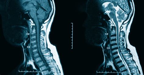 CT With Contrast And MRI With Contrast Facts To Know Touchstone Medical Imaging