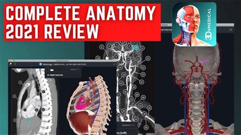 Complete Anatomy 21 3d Human Body Atlas Medical Student Review Youtube