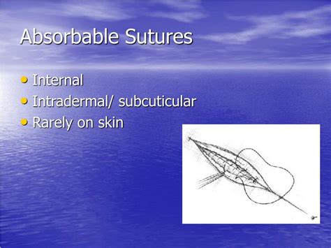 Ppt Suture Materials And Techniques Powerpoint Presentation Free