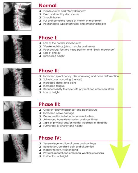 Levels Of Spinal Degeneration