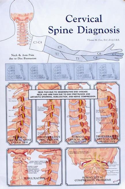 Cervical Spine Diagnosis Anatomy Poster Clinical Charts And Supplies