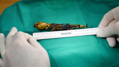 This Strange ‘alien Skeleton Is Actually A Human Fetus With Genetic