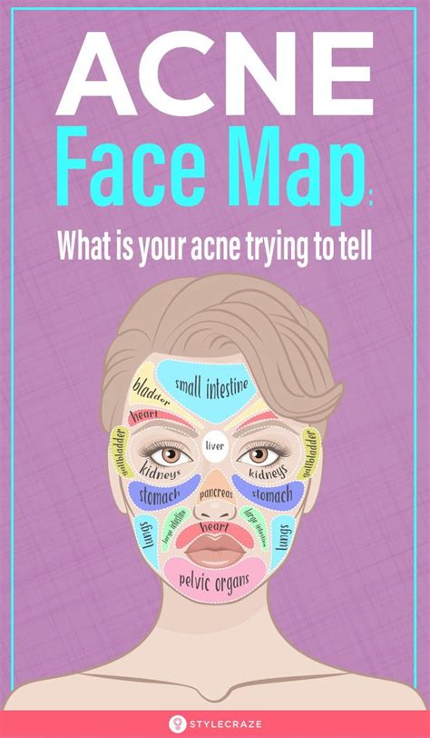 Acne Face Map What Your Breakouts Are Trying To Tell You Face