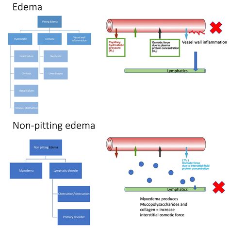 Pitting Vs Non Pitting Edema Differential Diagnosis For Grepmed