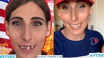 Chelsea Wolfe Teeth Fixed 2023, Before After Accident