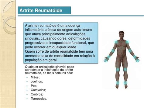 Artrite Reumatóide