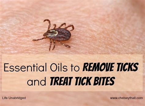 How To Treat Tick Bites