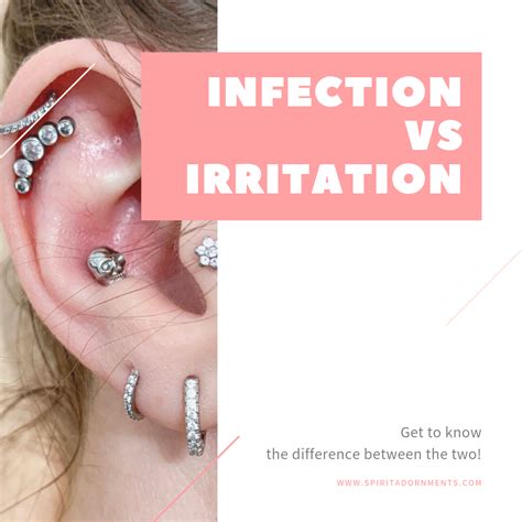 Piercing Infection Local Infection With Granuloma After Helix Piercing Result One Week