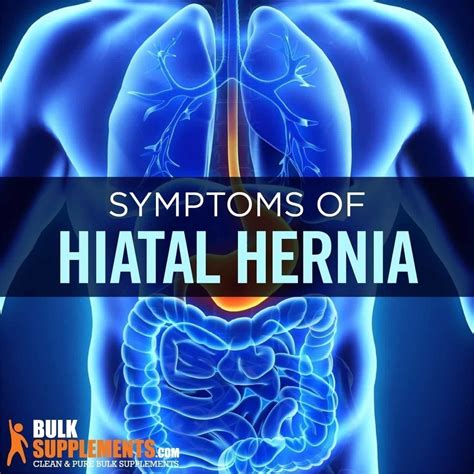 Tablo Read Hiatal Hernia Symptoms Causes Treatment By