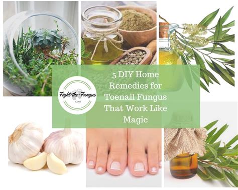 5 Diy Home Remedies For Toenail Fungus That Work Like Magic Toenail