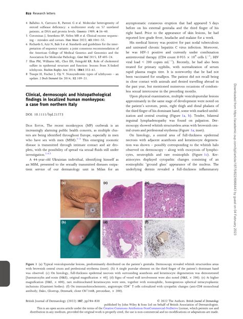 Pdf Clinical Dermoscopic And Histopathological Findings In Localized