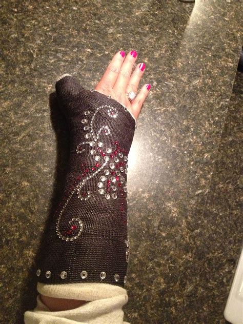 If your stuck with a cast Bling it! | Broken hand cast, Arm cast decorations, Arm cast