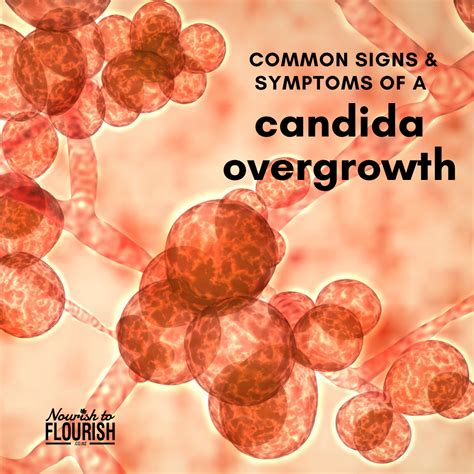 Candida Overgrowth Common Signs And Symptoms In Candida Overgrowth Candida Overgrowth