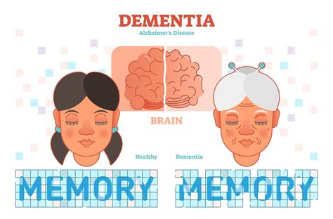 Dementia And Alzheimers Overview Causes Symptoms Treatment