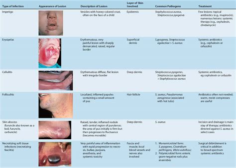 Common Skin Conditions Symptoms Treatment And Diagnosis SexiezPicz