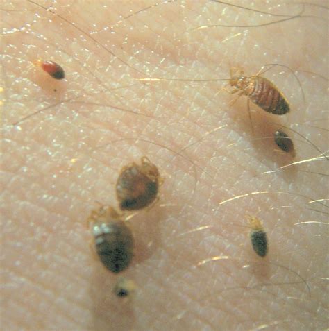 Bed Bugs Bites Mites Chanel Bed Bugs 0602b5