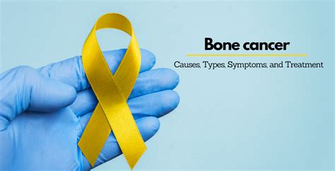 Bone Cancer Causes Types Symptoms And Treatment