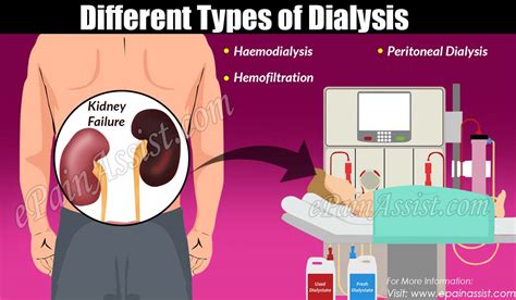 Different Types Of Dialysis And Its Advantages And Disadvantages