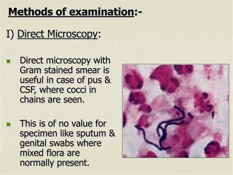 Ppt Streptococcus Powerpoint Presentation Free Download Id5596913