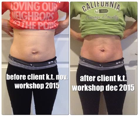 All New Before And After Pictures Healing The Diastasis Recti 2015