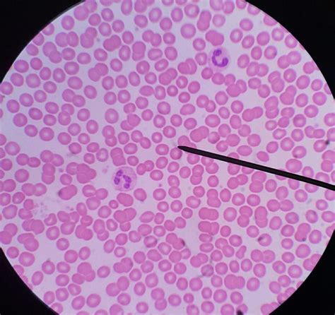 Monocito Neutrofilo Eritrocitos Decoração