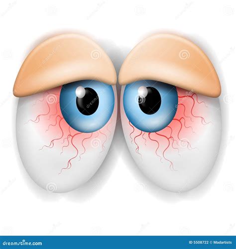 Droopy Tired Bloodshot Eyes Stock Illustration Illustration Of