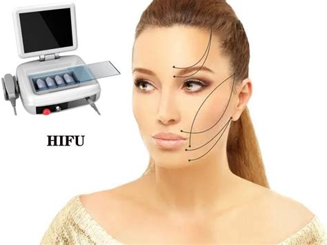 Portable Hifu Machine High Intensity Focused Ultrasound Ultherapy Face Zhengzhou Henan China