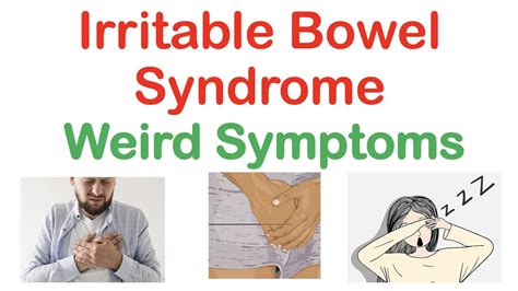 Weird Symptoms Of Irritable Bowel Syndrome Atypical Clinical Features Of Ibs Youtube