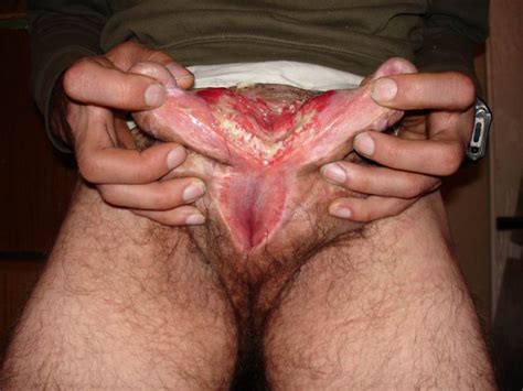 Strangest Penis Tubezzz Porn Photos