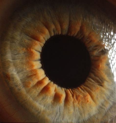 Incredible Microscopic Pictures Of The Human Eye Revealed Impact Lab