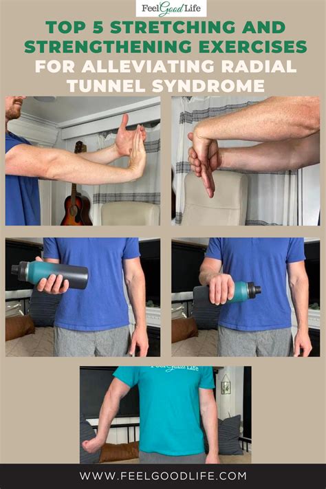Radial Tunnel Syndrome Is A Painful Condition That Can Affect The