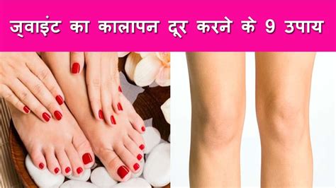 ज्वाइंट का कालापन दूर करने के 9 नुस्खेget Rid Of Dark Knuckleskneeselbows Get Soft Fair