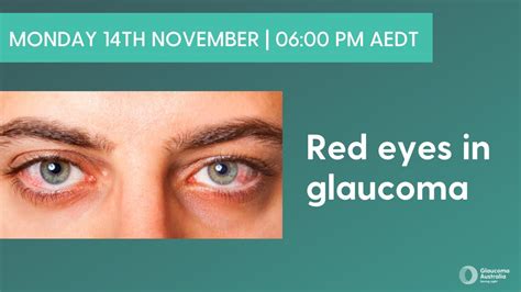 The Red Eye In Glaucoma Live Qanda With Professor Graham Lee Glaucoma
