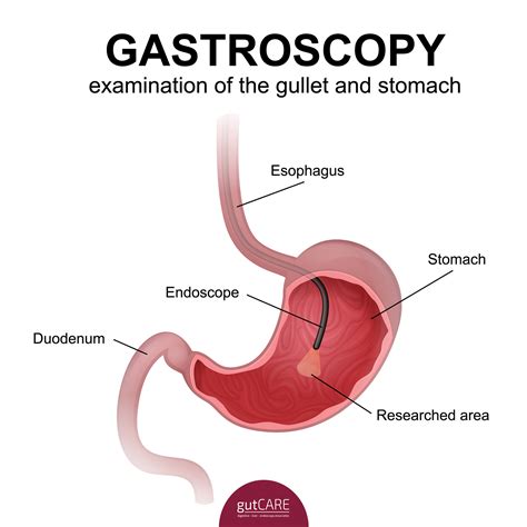 Gastrointestinal Endoscopy