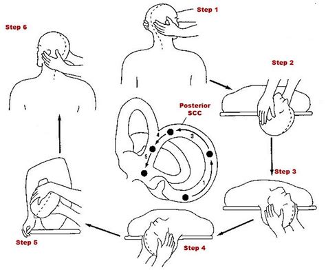 Epley Maneuver Instructions How To Do The Epley Maneuver At Home