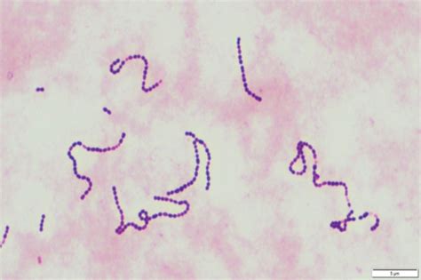 A Cerebrospinal Fluid Cultures Revealed β Hemolytic Streptococci That