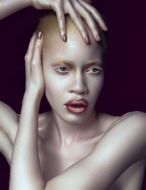 FAB Beauty African American Albino Model Diandra Forrest For Schön Magazine Spring Summer