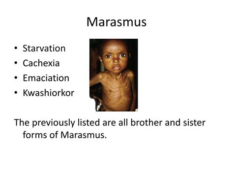 Emaciation is defined as extreme weight loss and unnatural thinness due to a loss of subcutaneous fat (the fatty, or adipose tissue beneath the skin) and muscle throughout the body. PPT - Marasmus PowerPoint Presentation, free download - ID ...