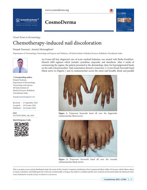 Pdf Chemotherapy Induced Nail Discoloration