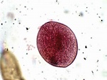 Balantidium coli – Cyst – Parasitology