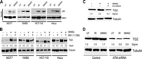 Tg2 Expression During Dna Damage Response Is Controlled By The Atmnfb