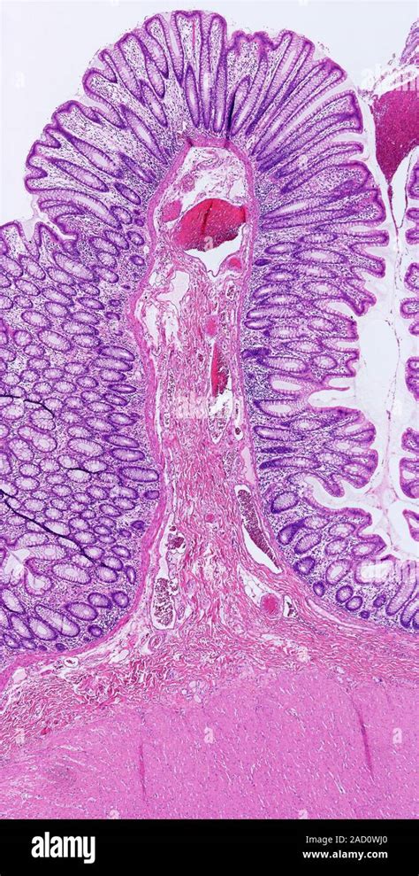 Light Microscopy Of Human Normal Large Bowel Mucosa The Mucosa
