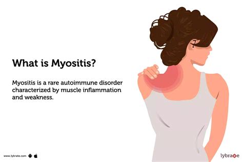 Myositis Causes Symptoms Treatment