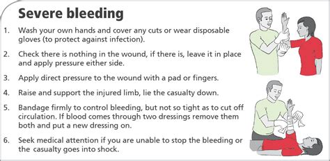 How To Deal With Severe Bleeding Our Aim Is To Have A First Aider On