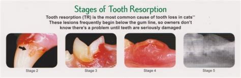 Periodontitis can cause teeth to loosen or lead to tooth loss. Dental and Oral Surgery