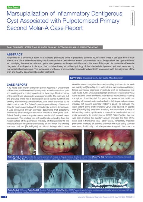 Pdf Marsupialization Of Inflammatory Dentigerous Cyst Associated With