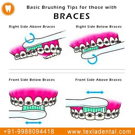 have you ever wondered how people with braces should brush now you know basic brushing tips