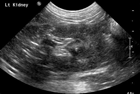 Small Animal Abdominal Ultrasonography Part 1 A Tour Of The Abdomen