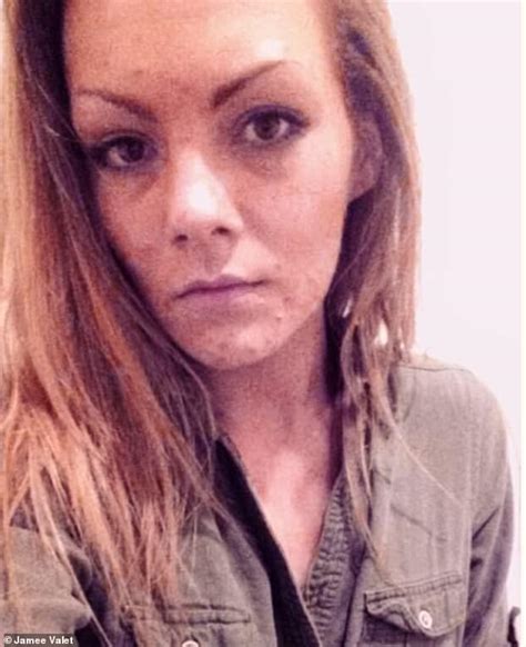 Incredible Before And After Pictures Show How Pock Marked Meth Addict Turned Her Life Around